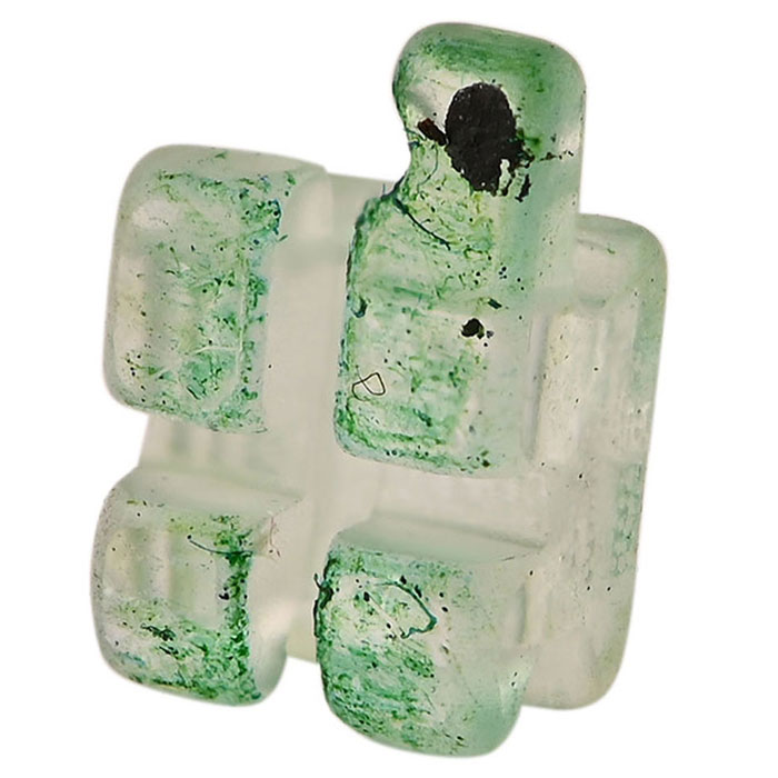 براکت سرامیکی (Sapphire)Protect - 3