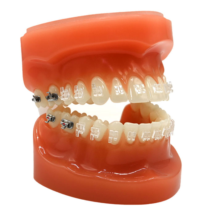 تایپودونت (مدل دندان) American Orthodantics - 1